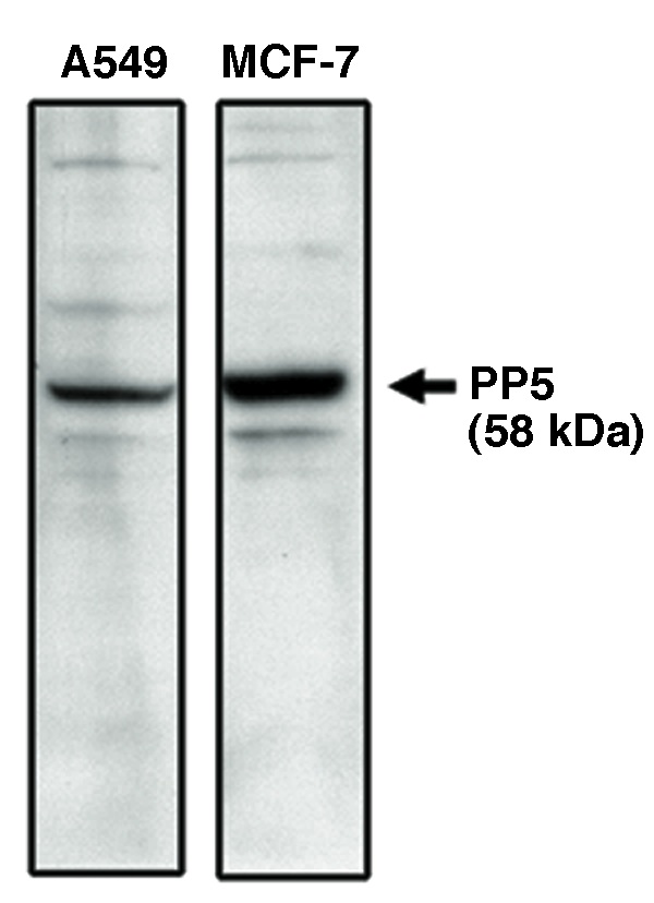"
Western blot analysis
using PP5 specific
antibody on A549 and
MCF-7 cell lysates."